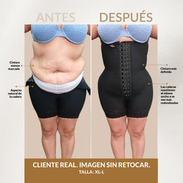 Faja Luxury Queen caderas anchas:  Ideal para BBL ( Ref. LUXBBL-013 / LUXBBL-213 )
